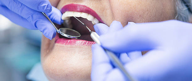Best Emergency Root Canal Treatment in Marion, NC
